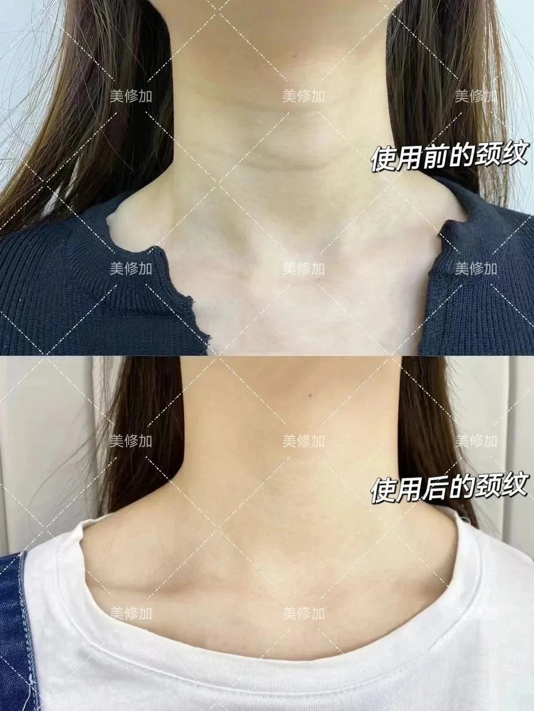 美修加奢宠丝滑美颈尊享套(紧致，提拉) 图片 10