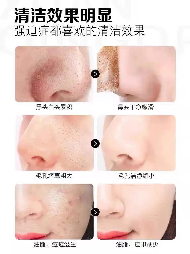 普罗雅苏焕颜靓肤膜，草本皮膜，斯拉皮膜 图片 13