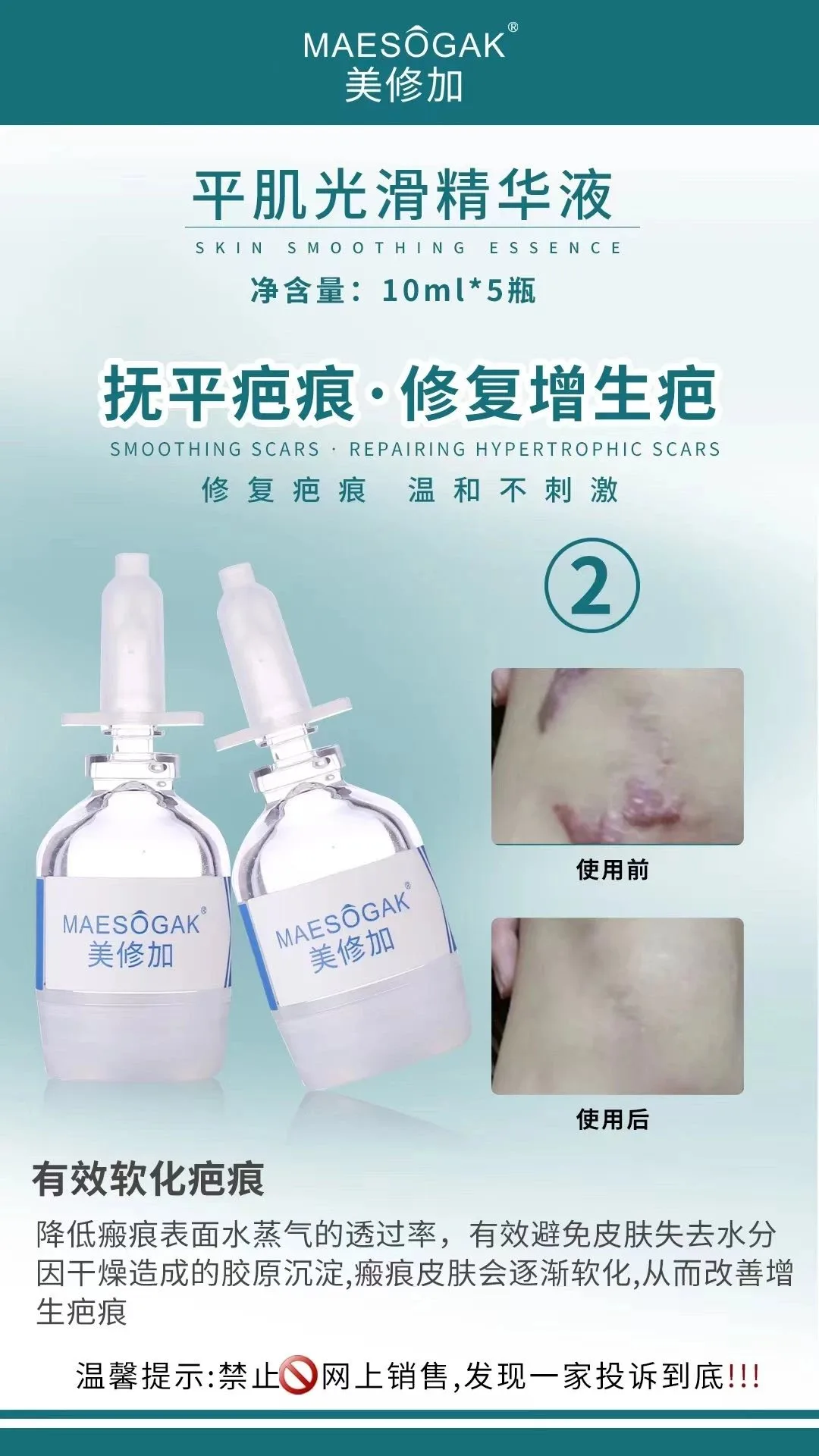 美修加【平肌光滑组合套】凸疤增生疤套盒 图片 8