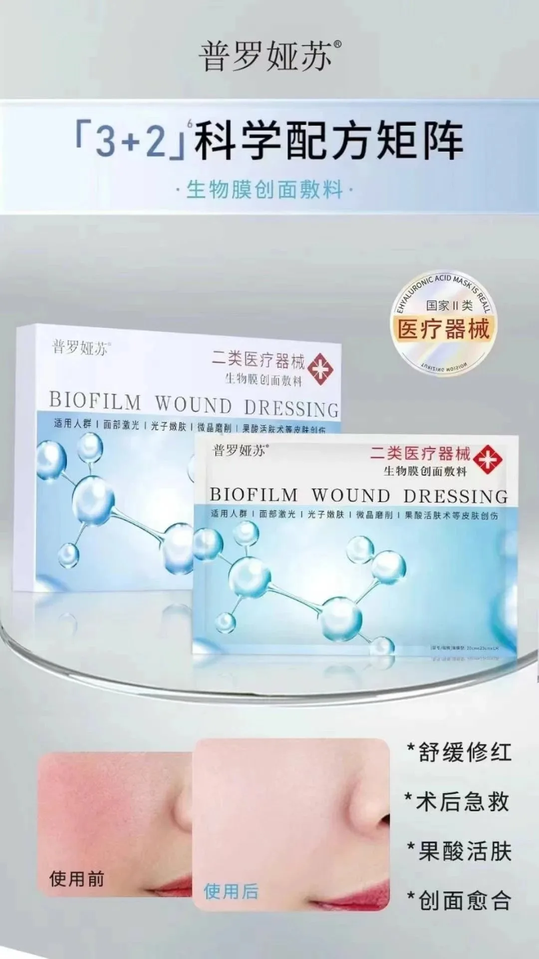 普罗娅苏生物膜创面敷料面膜，二类面膜，（浅蓝色款面膜） 图片 4