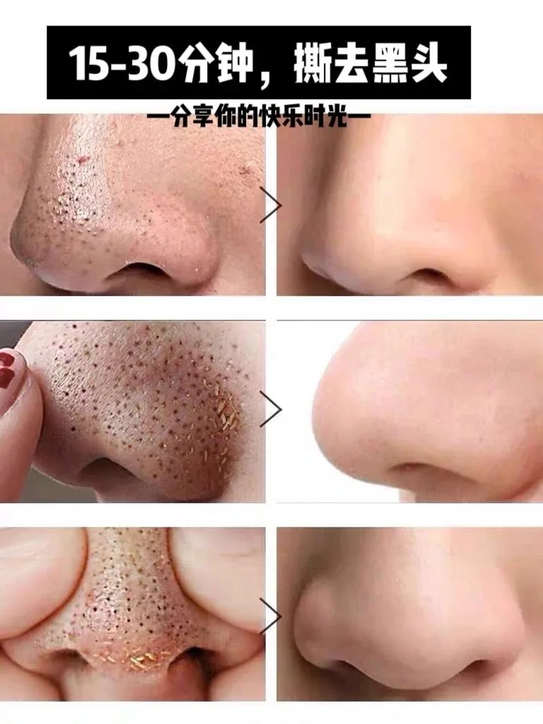 普罗雅苏焕颜靓肤膜，草本皮膜，斯拉皮膜 图片 3