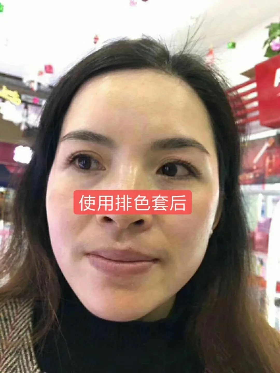 祛斑，排色套，面部靓肤液10毫升，3支装 图片 4