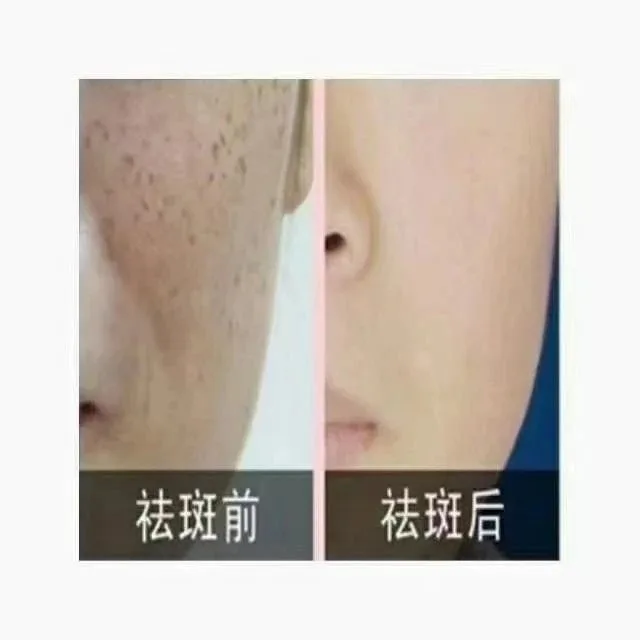 色素分解液套盒 【色素分解液】 图片 6