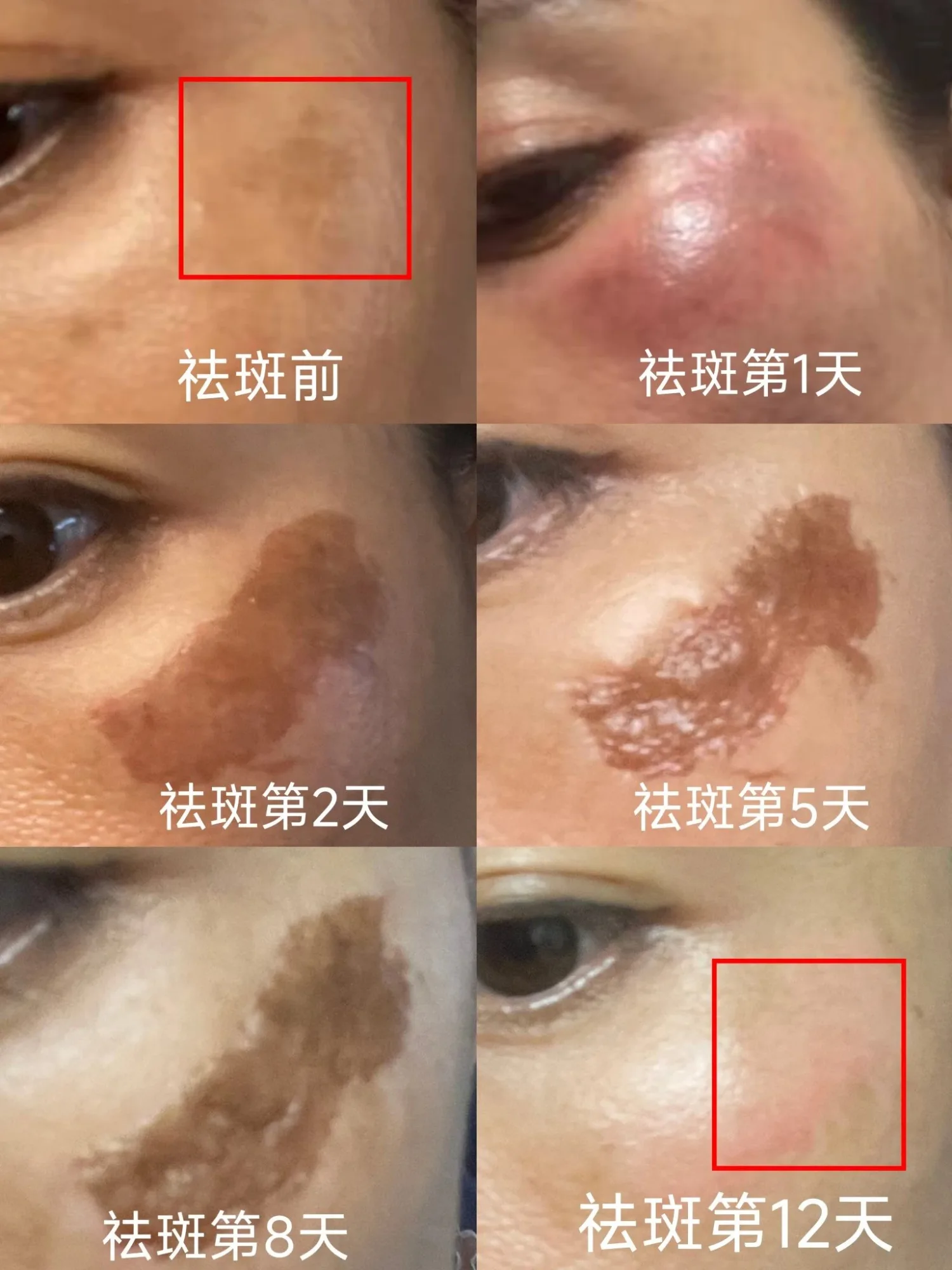 神奇点斑水 图片 11