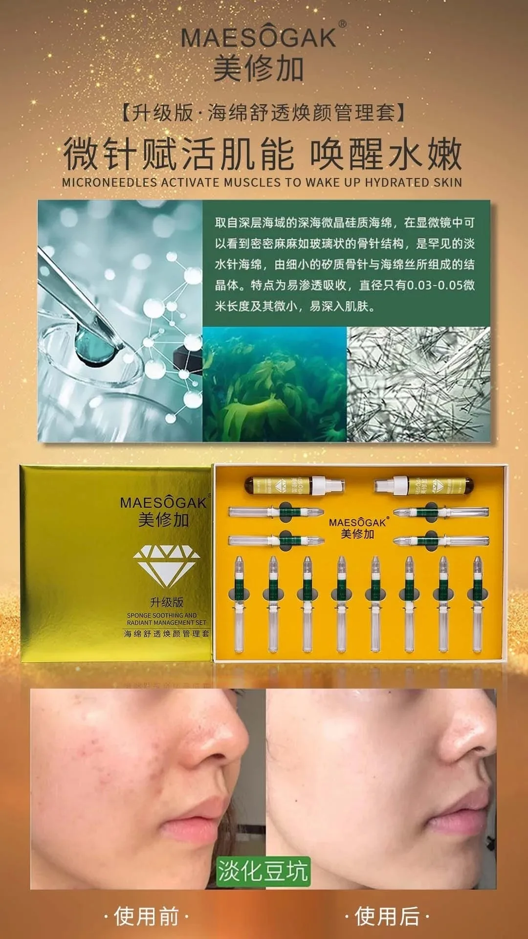 美修加海绵舒透焕颜管理套（金色12次装），海绵骨针12次装，升级款 图片 1