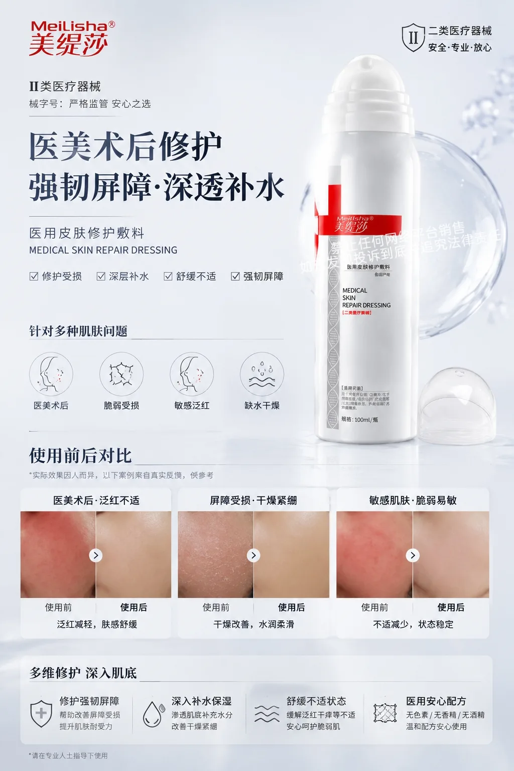 美缇莎医用二类修护喷雾 图片 6