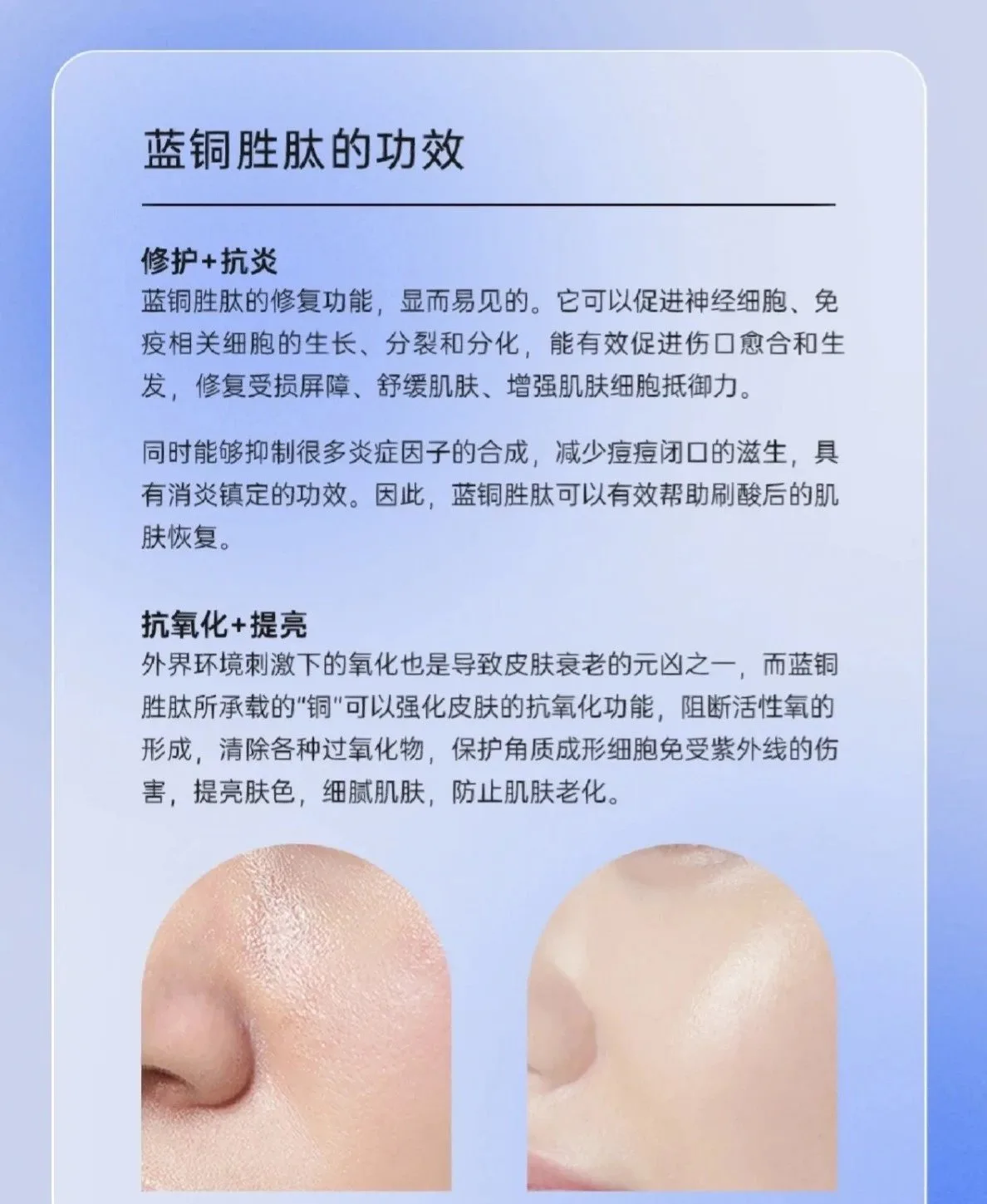 普罗娅苏蓝铜胜肽修肤肌底冻干粉套 图片 14
