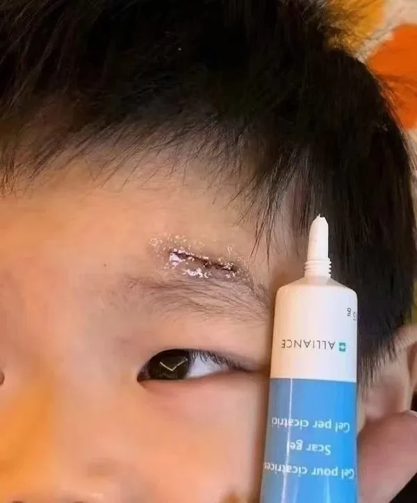 美国疤痕膏 图片 6