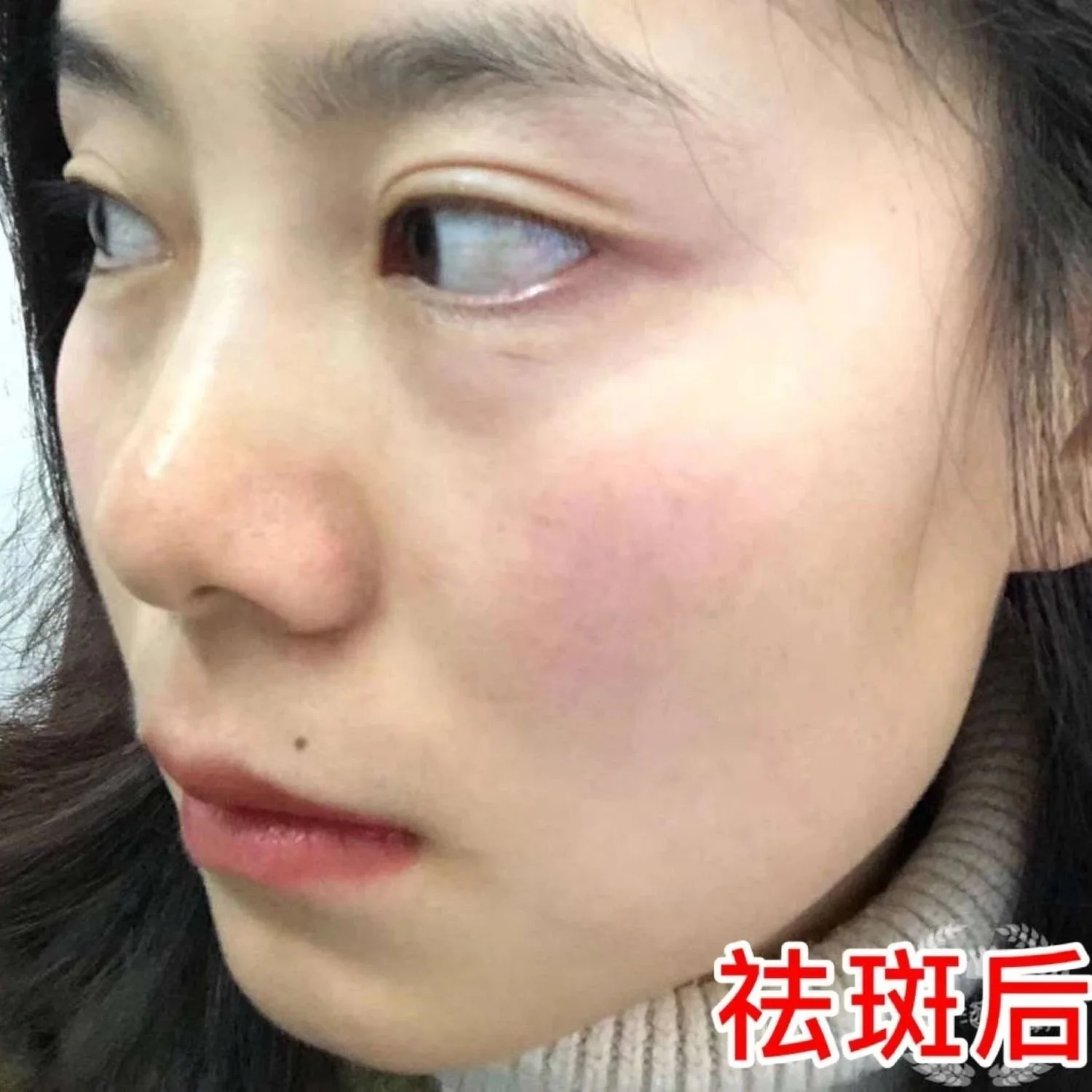 祛斑排色液，保养液 图片 9