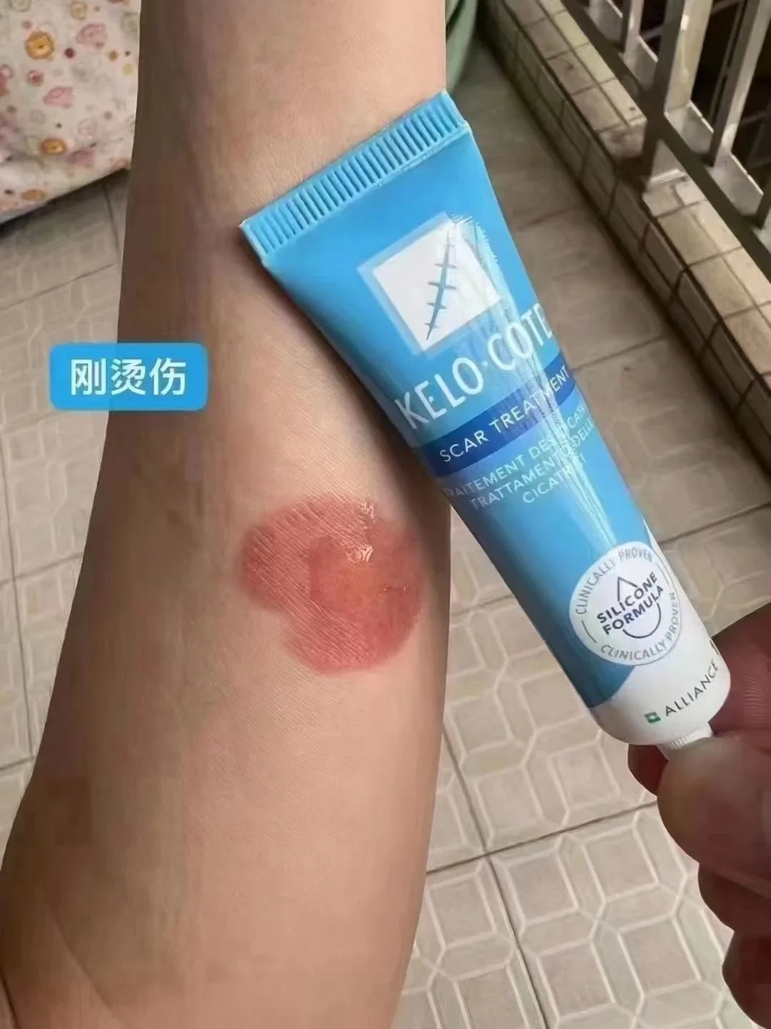 美国疤痕膏 图片 3