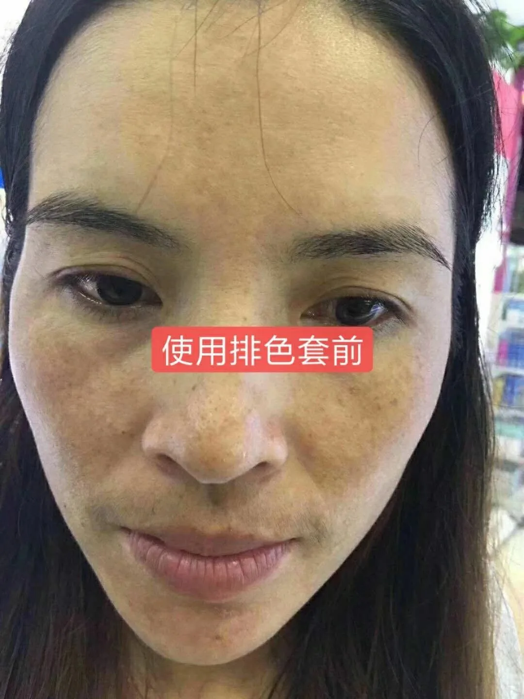 祛斑，排色套，面部靓肤液10毫升，3支装 图片 3