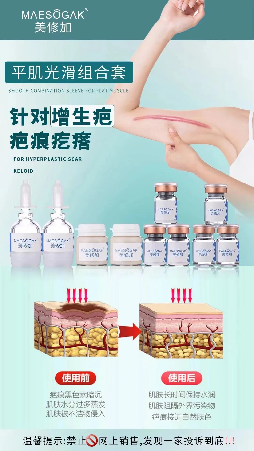 美修加【平肌光滑组合套】凸疤增生疤套盒 图片 6
