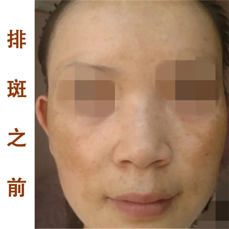 祛斑排色液，保养液 图片 6