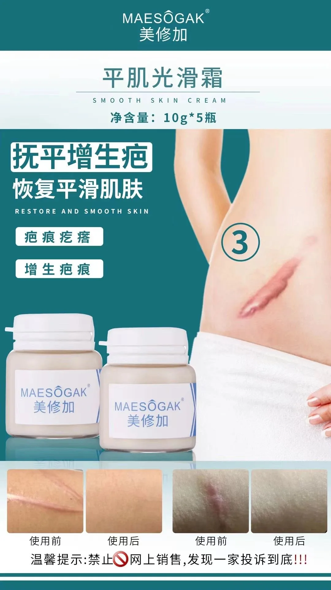 美修加【平肌光滑组合套】凸疤增生疤套盒 图片 9