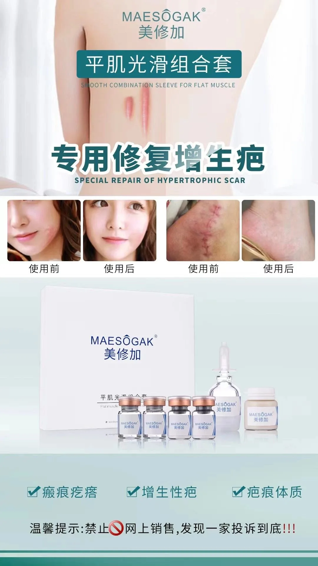 美修加【平肌光滑组合套】凸疤增生疤套盒 图片 3