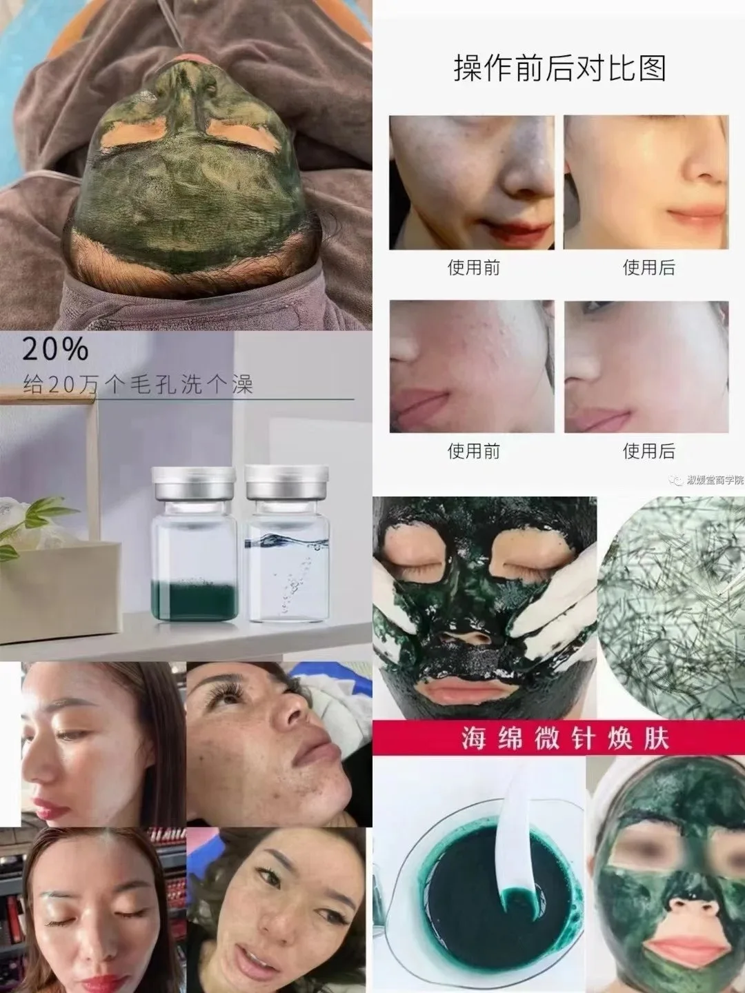 普罗娅苏海绵微晶组合套(淡化痘印，肌肤暗沉) 图片 11