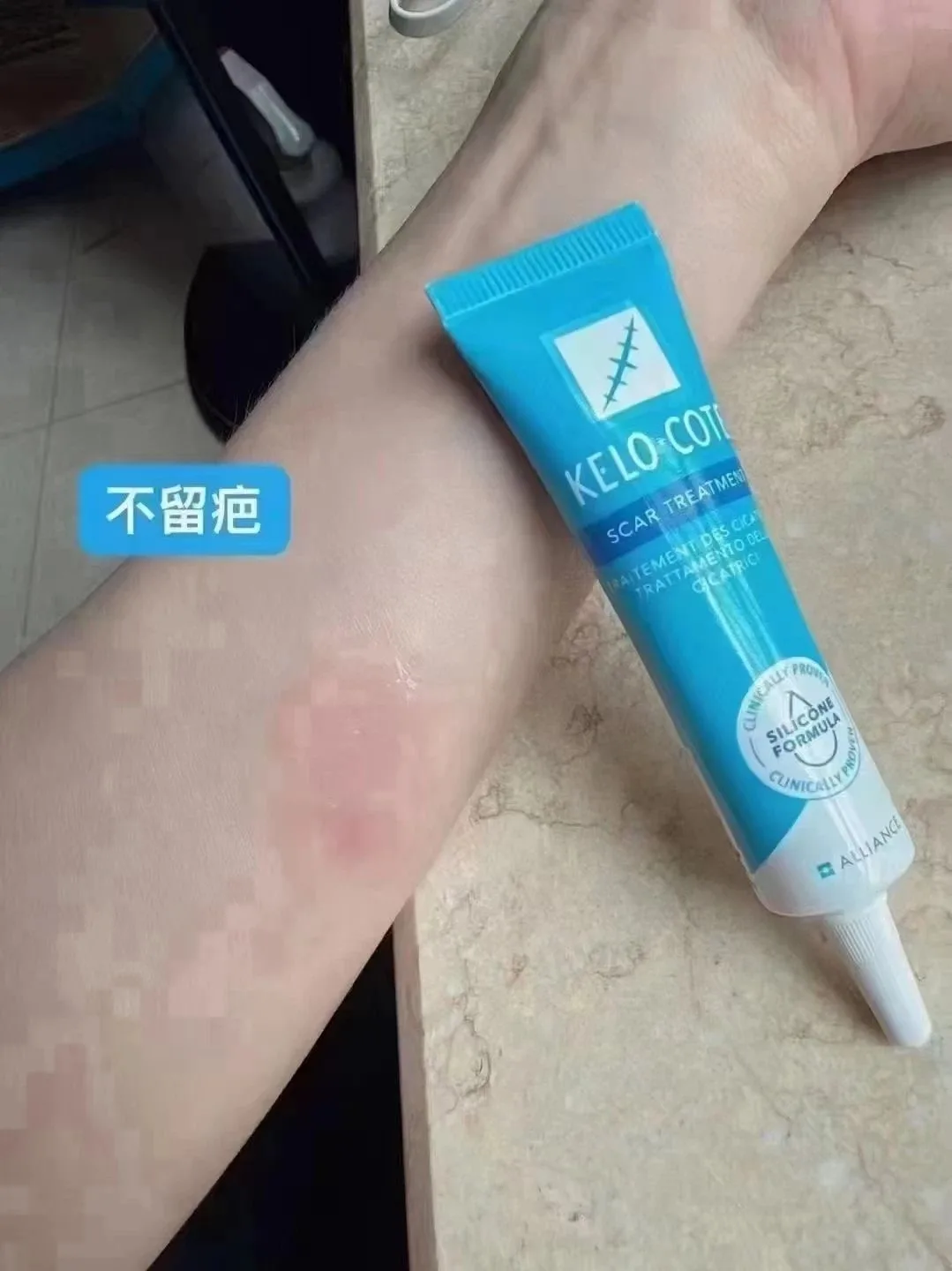 美国疤痕膏 图片 5