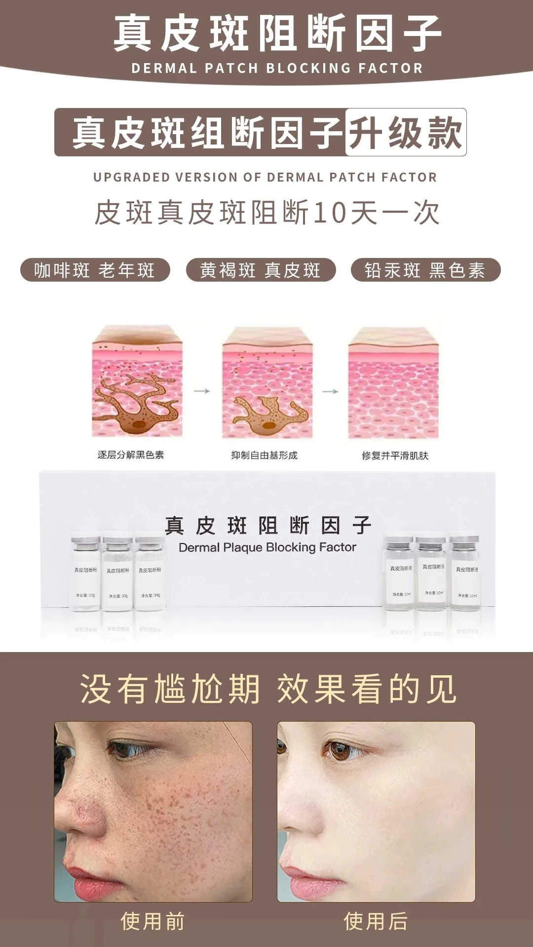 祛斑，真皮斑组断因子升级款 图片 5