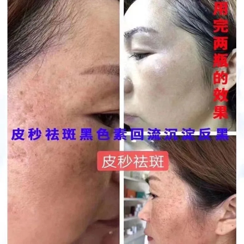 普罗娅苏美颜靓肤膏 图片 9