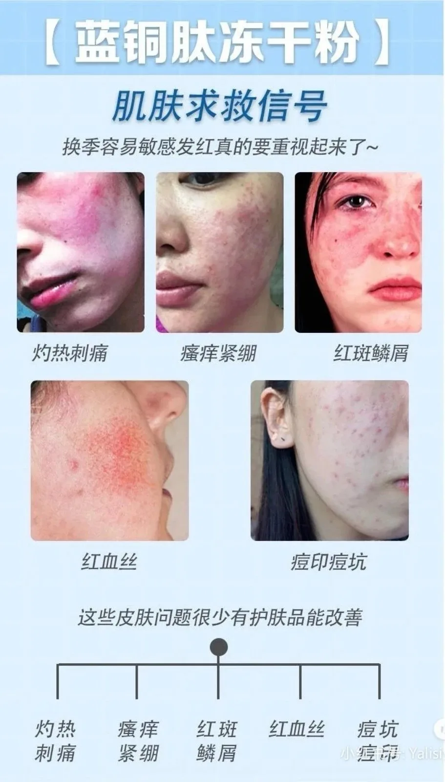 普罗娅苏蓝铜胜肽修肤肌底冻干粉套 图片 10