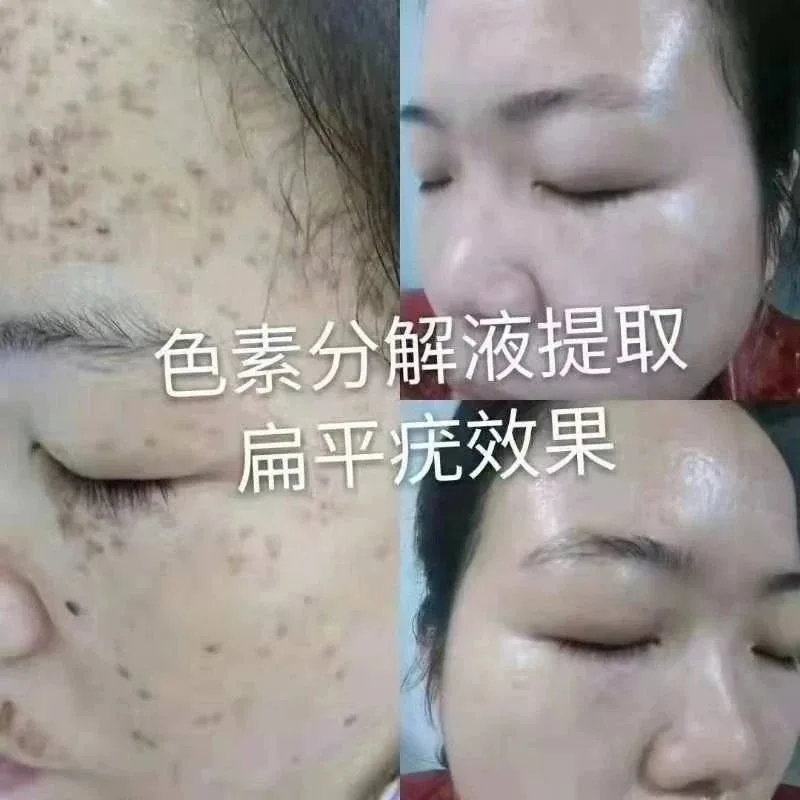 色素分解液套盒 【色素分解液】 图片 7