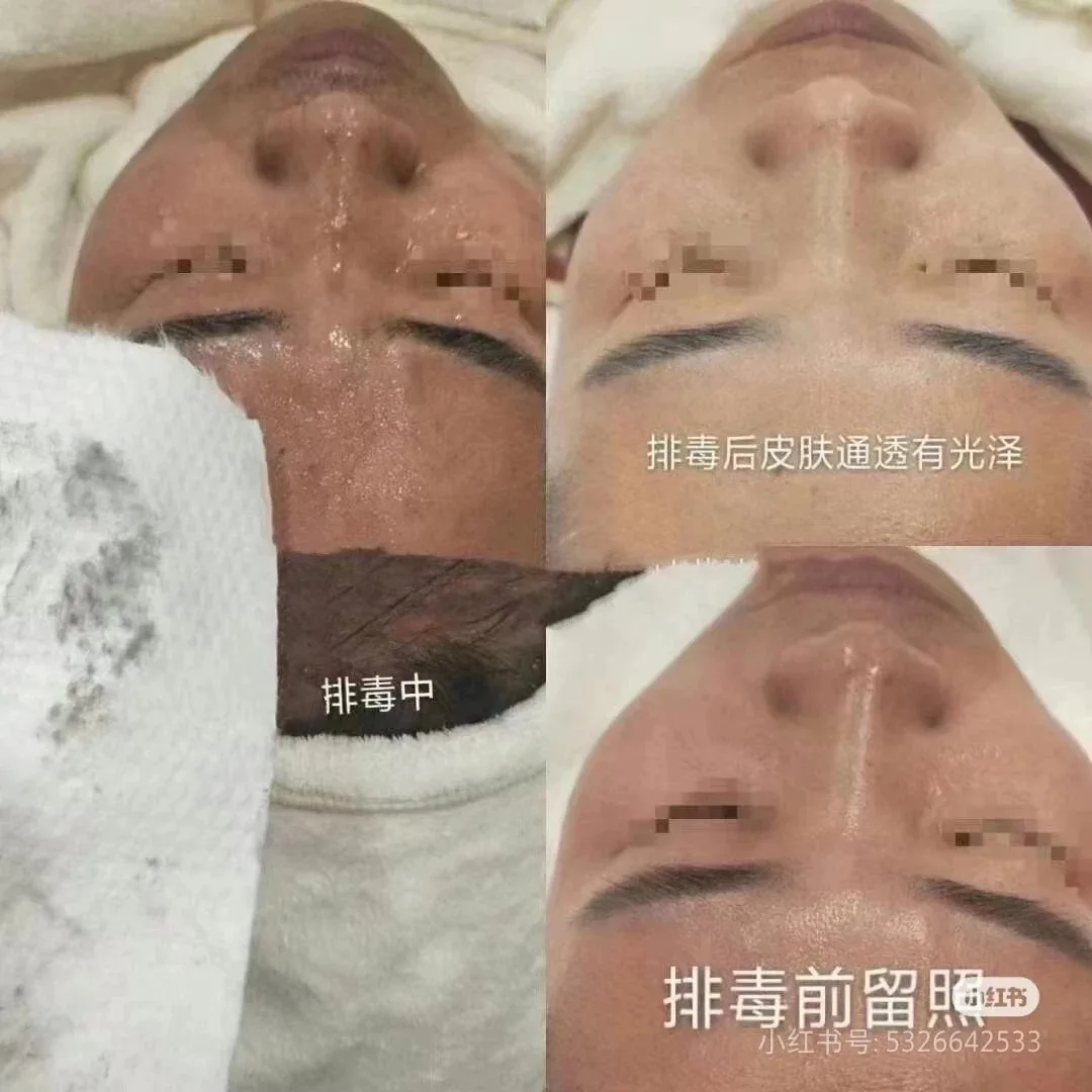 美修加孔雀石精华液，净肤排铅汞水光精华液， 高端皮套盒 图片 9