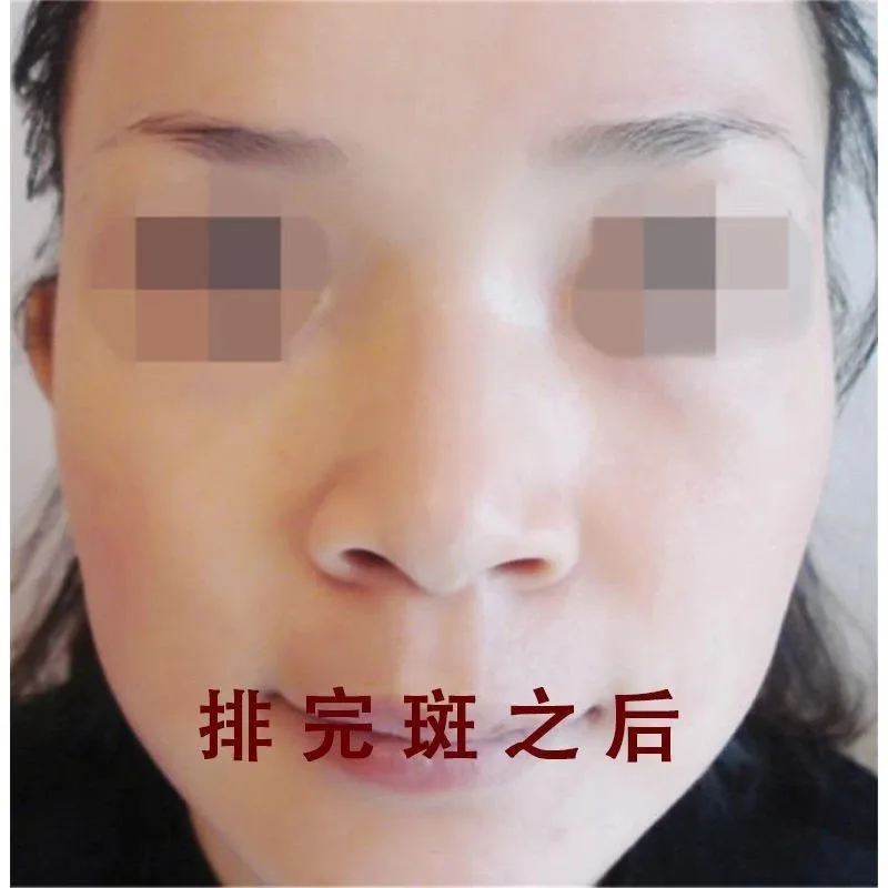 祛斑排色液，保养液 图片 7