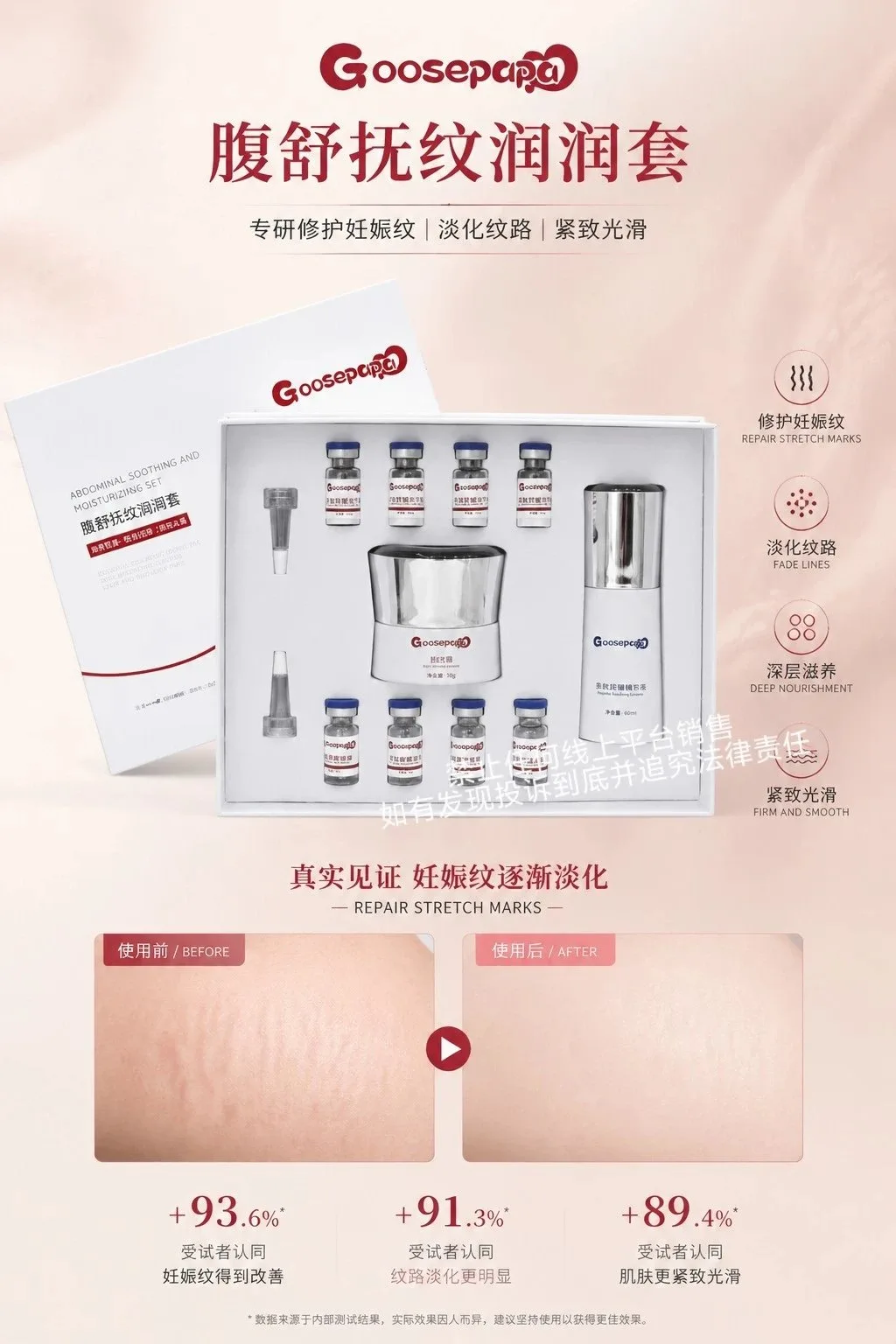 Goosepapa腹舒抚纹润润套（妊娠纹套） 图片 9