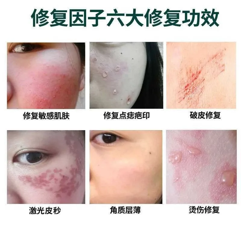 修护因子（油性膏体），点斑点痣修护膏 图片 10