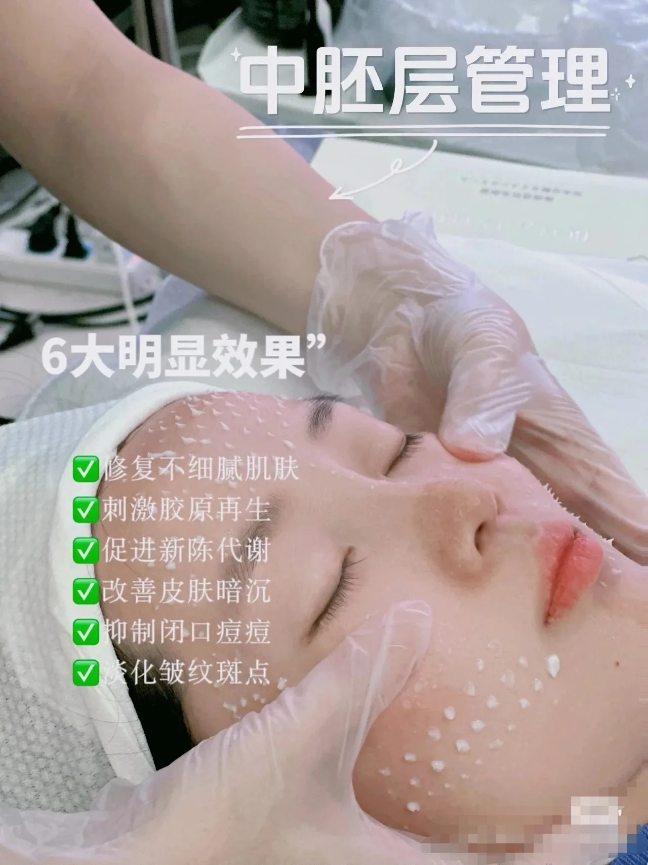普罗娅苏白钻胶原秘龄套，海绵骨针，种钻石 图片 16
