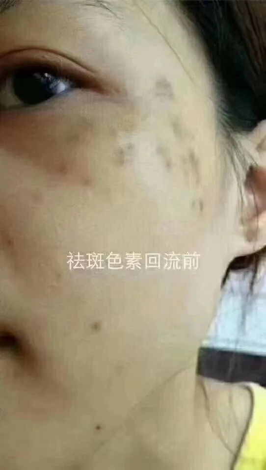 普罗娅苏美颜靓肤膏 图片 11