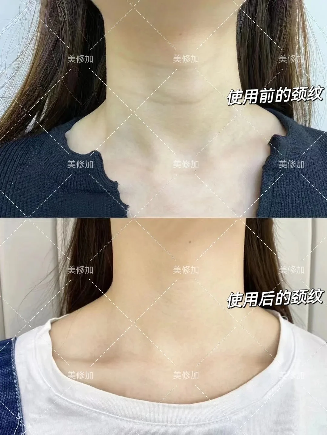 美修加精致美颈接摩膏，-颈部滚滚霜120克 图片 7