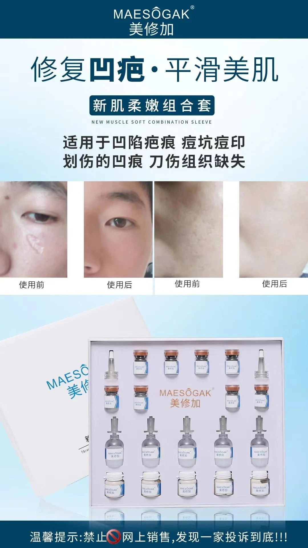 美修加【新肌柔嫩组合套】【凹疤套盒】 图片 3