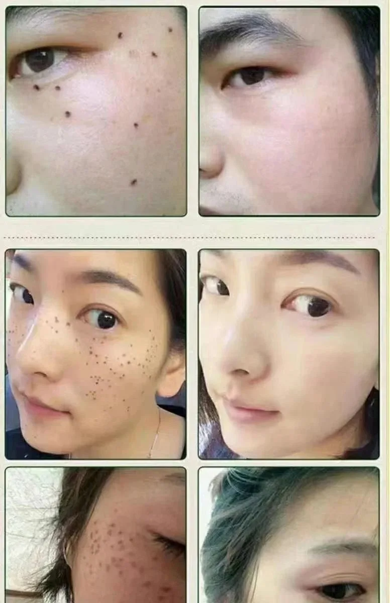 色素分解液套盒 【色素分解液】 图片 9