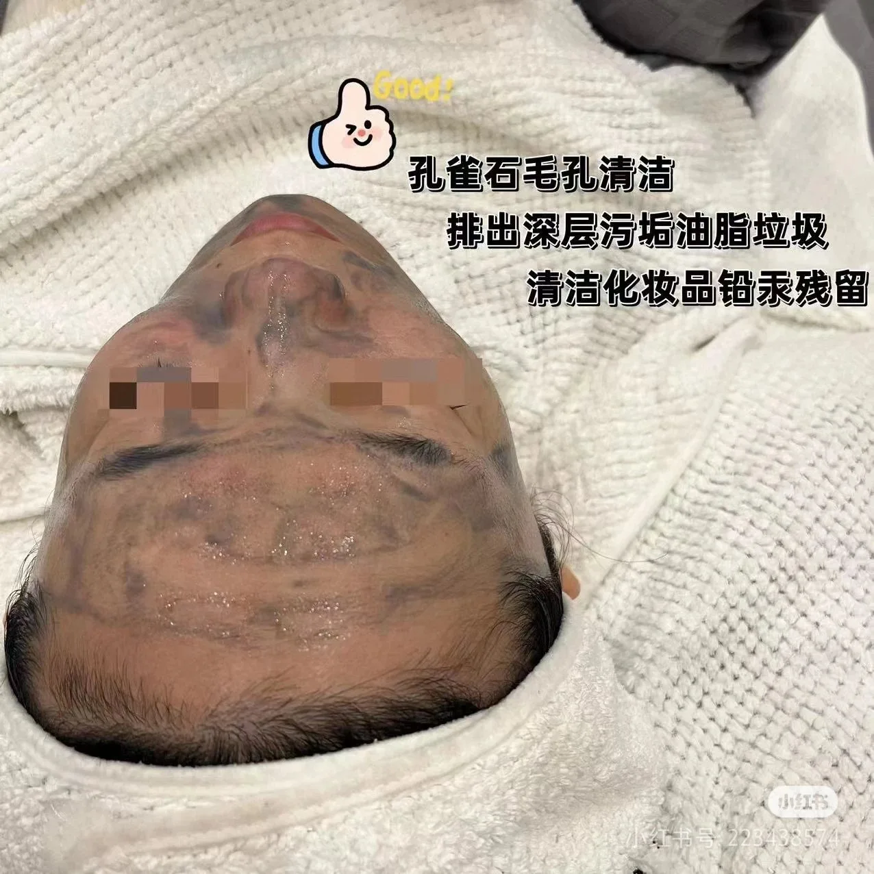 美修加孔雀石精华液，水光套盒 图片 9