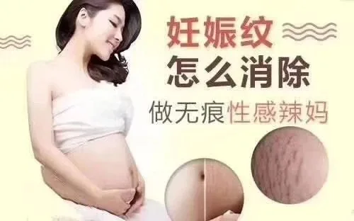 美修加靓腹美肌组合套，妊娠纹套盒 图片 10