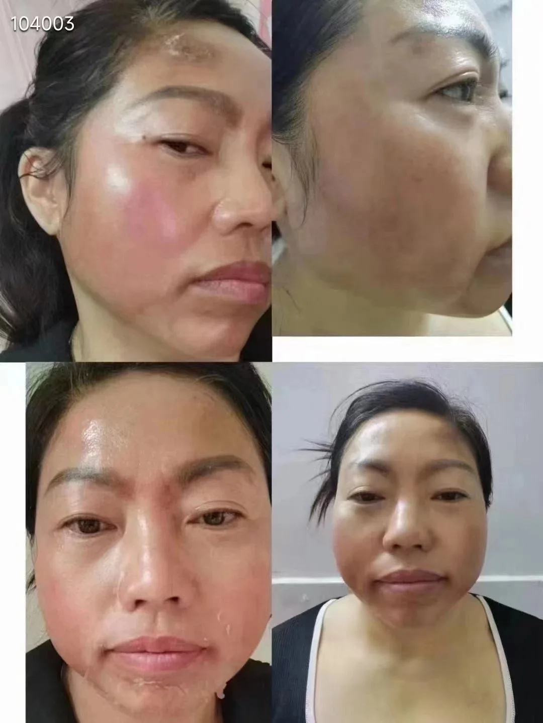 徒手揉斑术B款包装四件套 图片 14