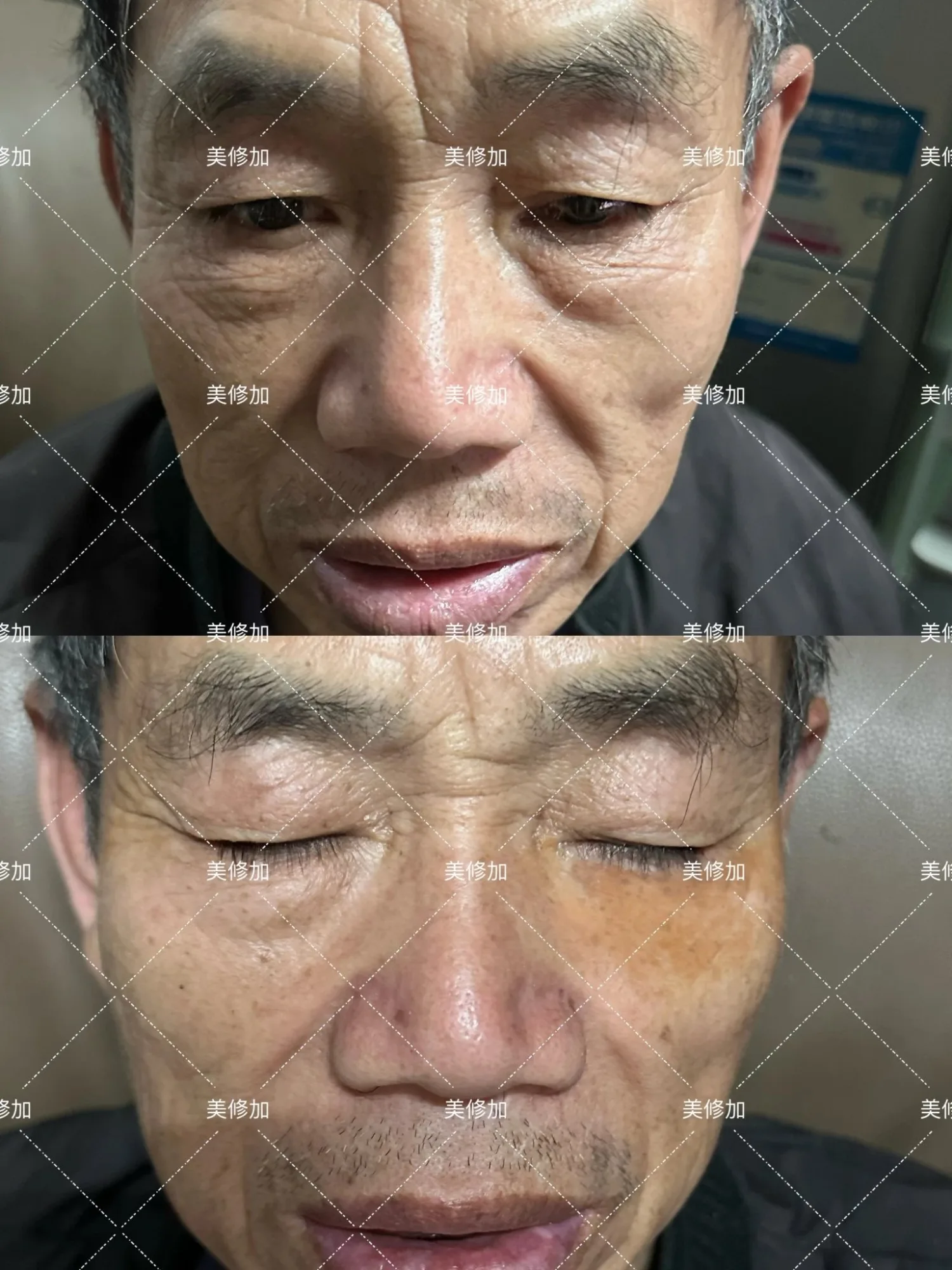 美修加六胜肽抗皱精华乳(抗皱) 图片 16