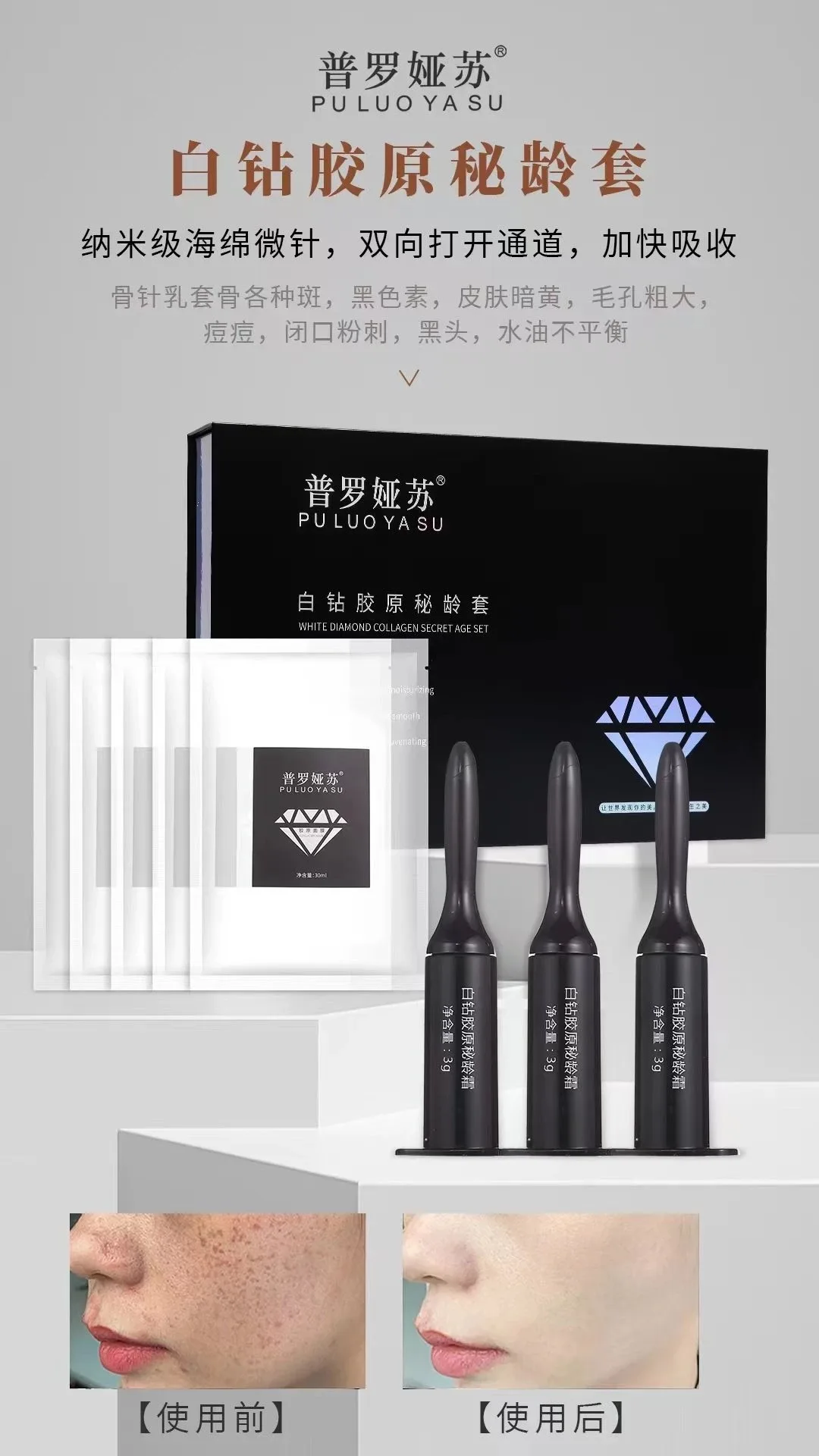 普罗娅苏白钻胶原秘龄套，海绵骨针，种钻石 图片 6