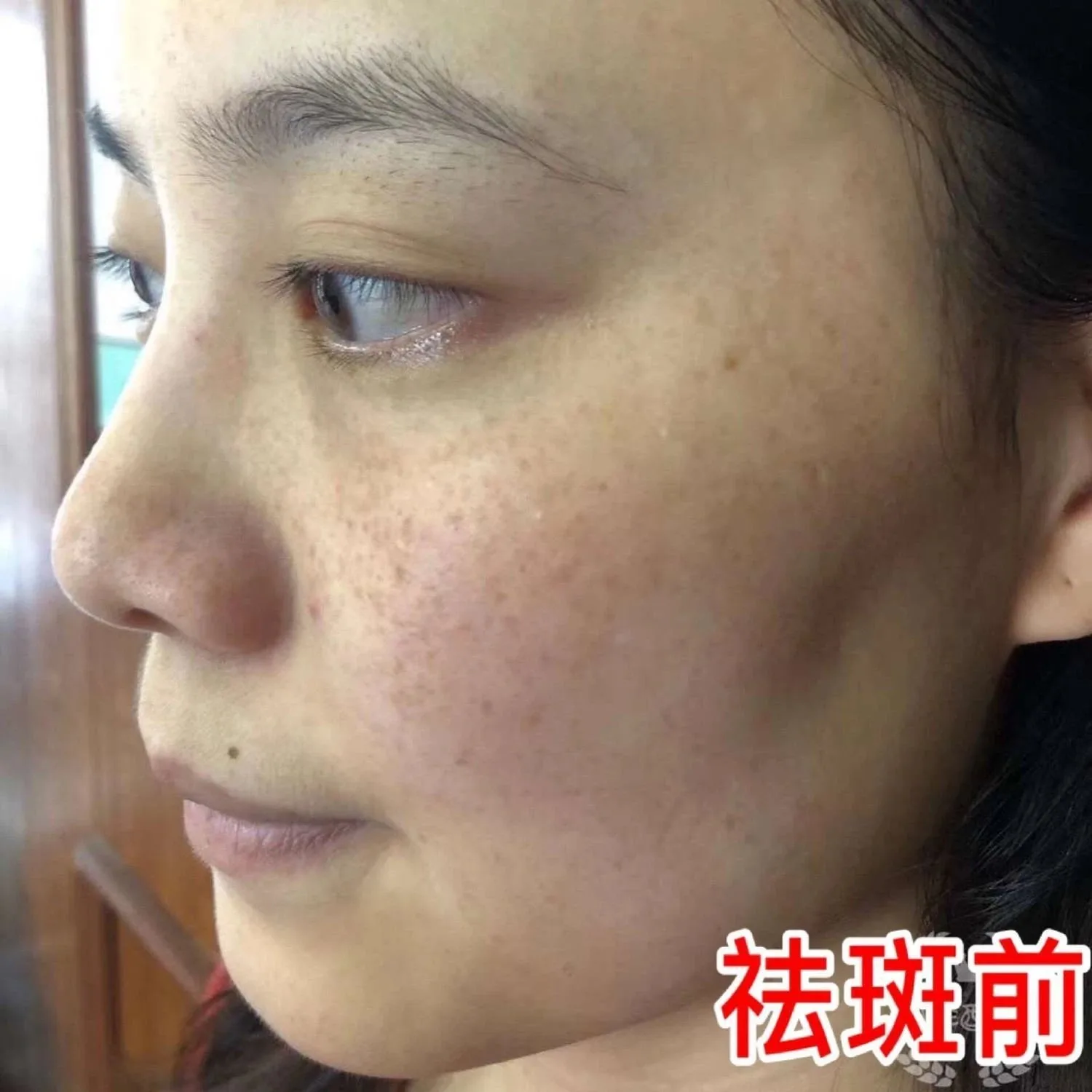 祛斑排色液，保养液 图片 8