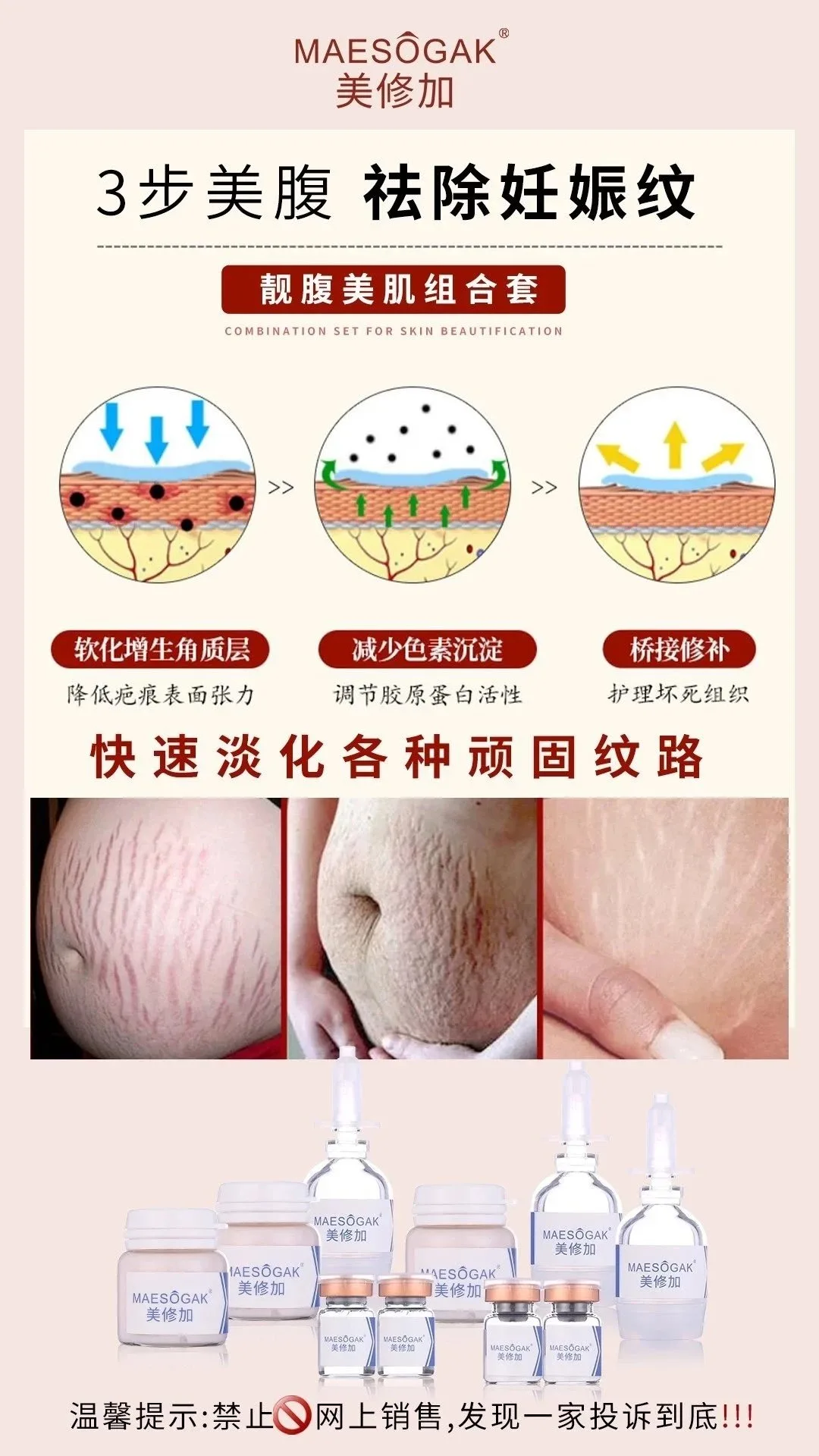 美修加靓腹美肌组合套，妊娠纹套盒 图片 7