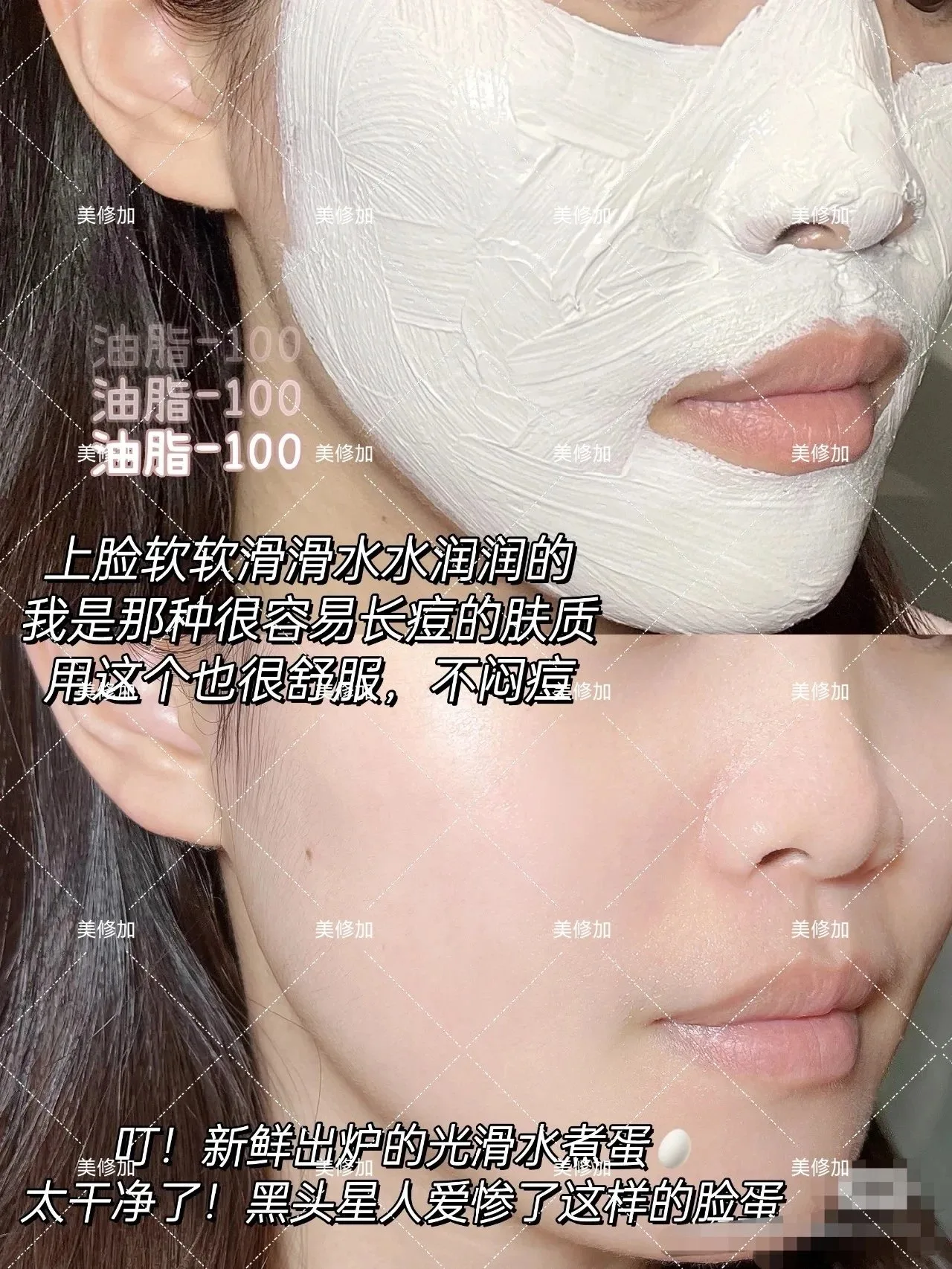 美修加水杨酸净颜呵护泥膜 图片 4