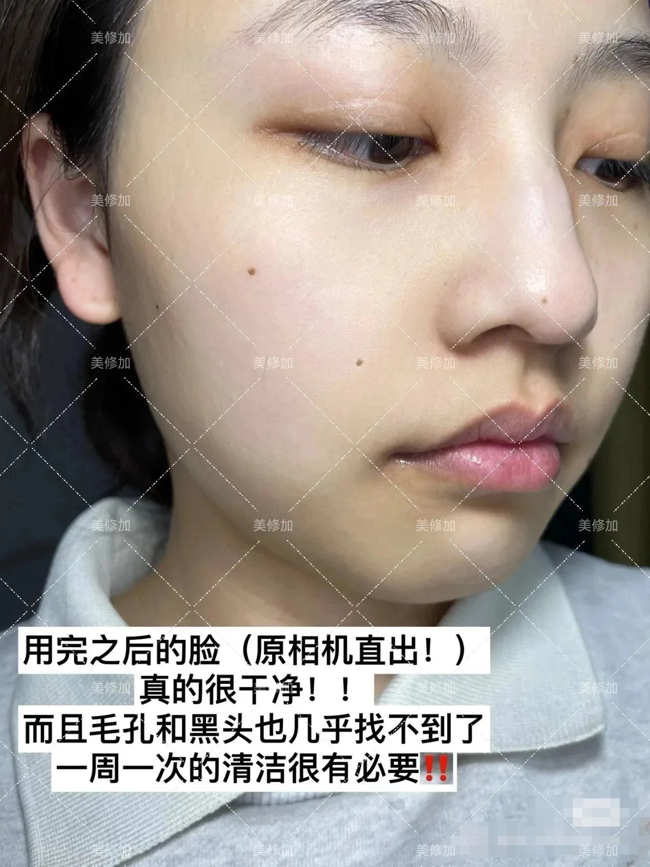 美修加果酸靓颜美肌嫩肤泥膜，祛痘泥膜 图片 10