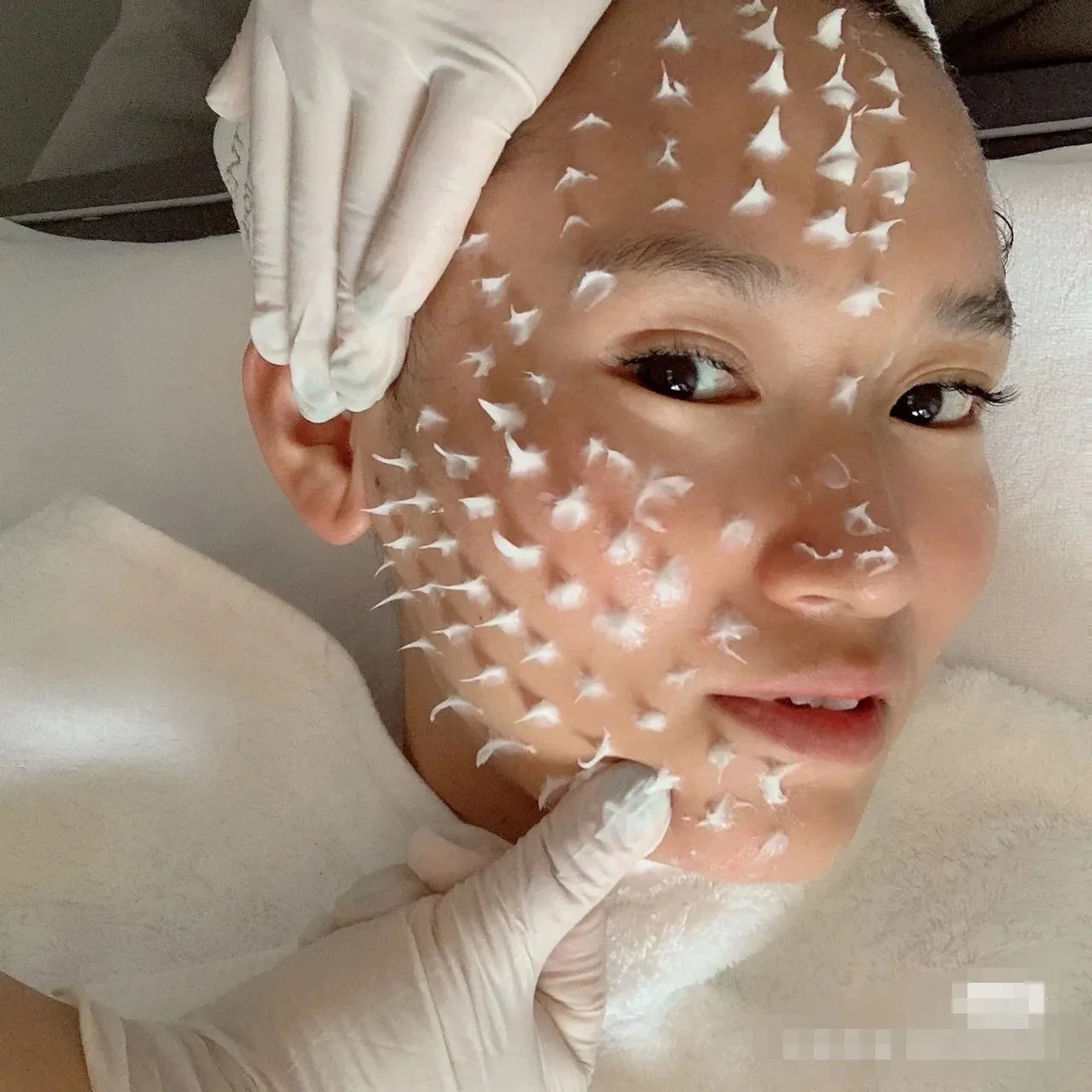 美缇莎胶原舒润美肌套至尊二(骨针) 图片 14