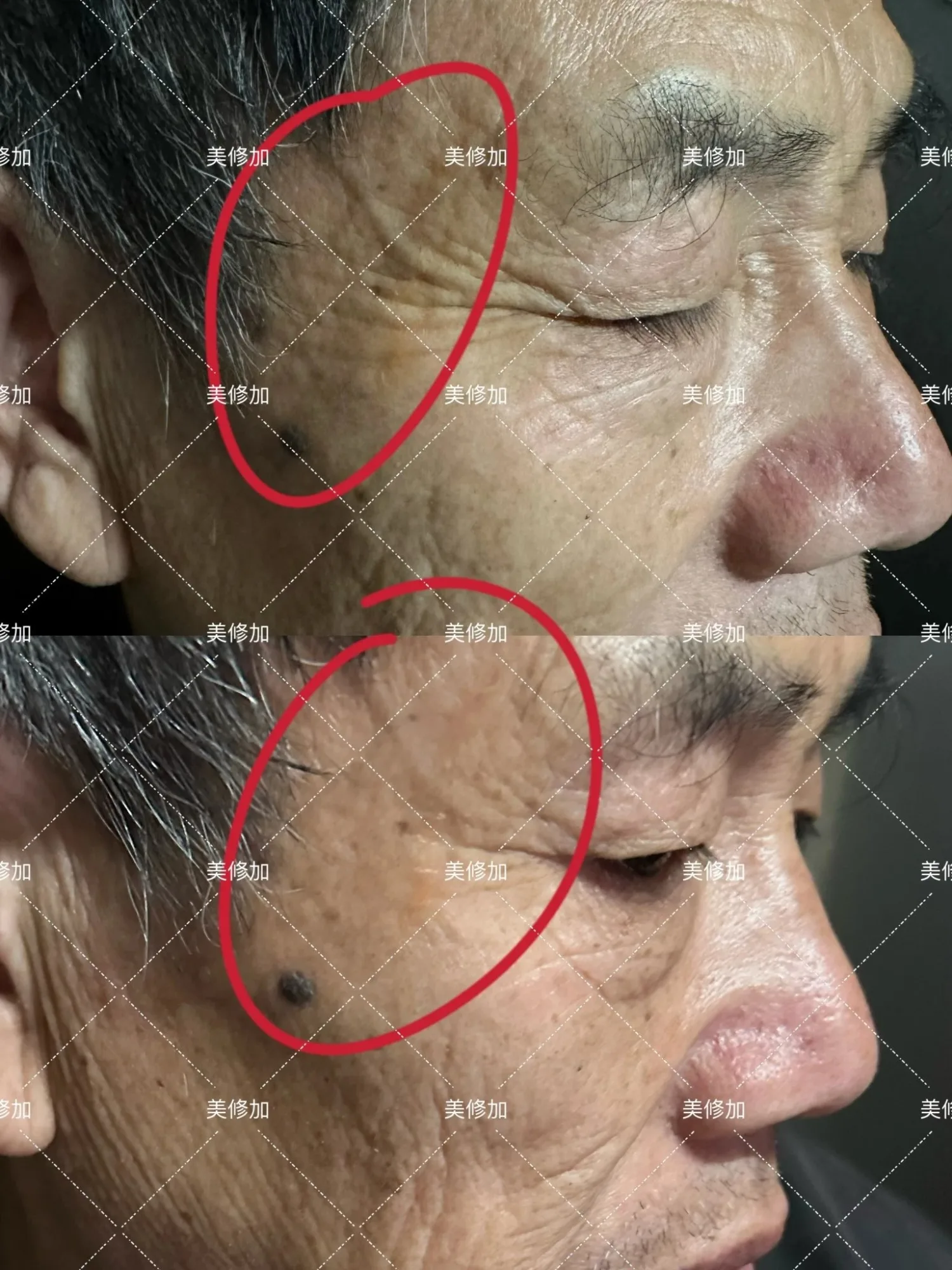 美修加六胜肽抗皱精华乳(抗皱) 图片 15