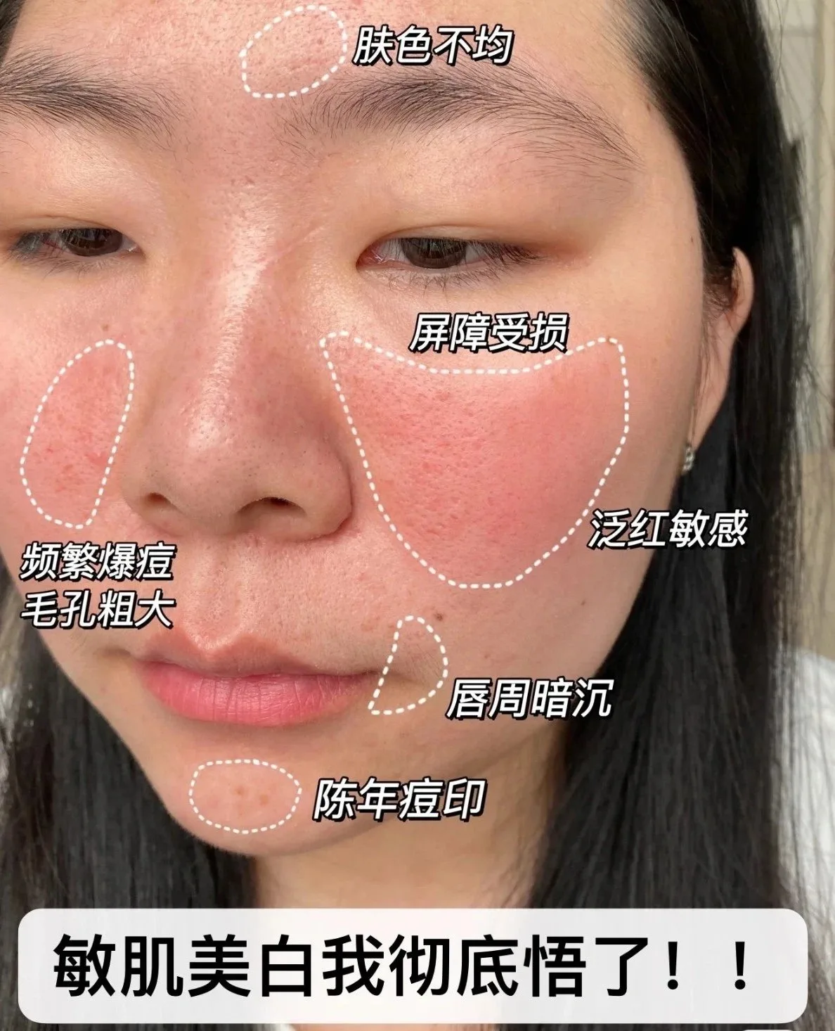 普罗娅苏蓝铜胜肽修肤肌底冻干粉套 图片 8