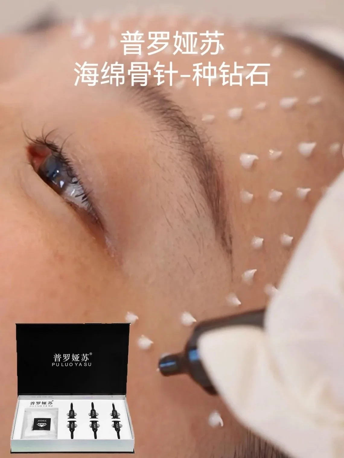 普罗娅苏白钻胶原秘龄套，海绵骨针，种钻石 图片 3