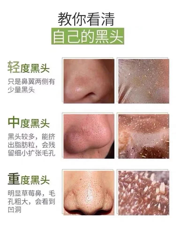 普罗雅苏焕颜靓肤膜，草本皮膜，斯拉皮膜 图片 5