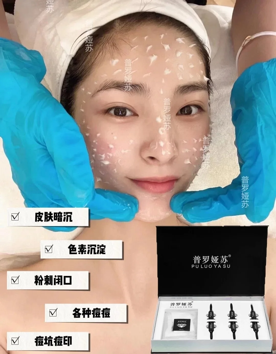 普罗娅苏白钻胶原秘龄套，海绵骨针，种钻石 图片 4