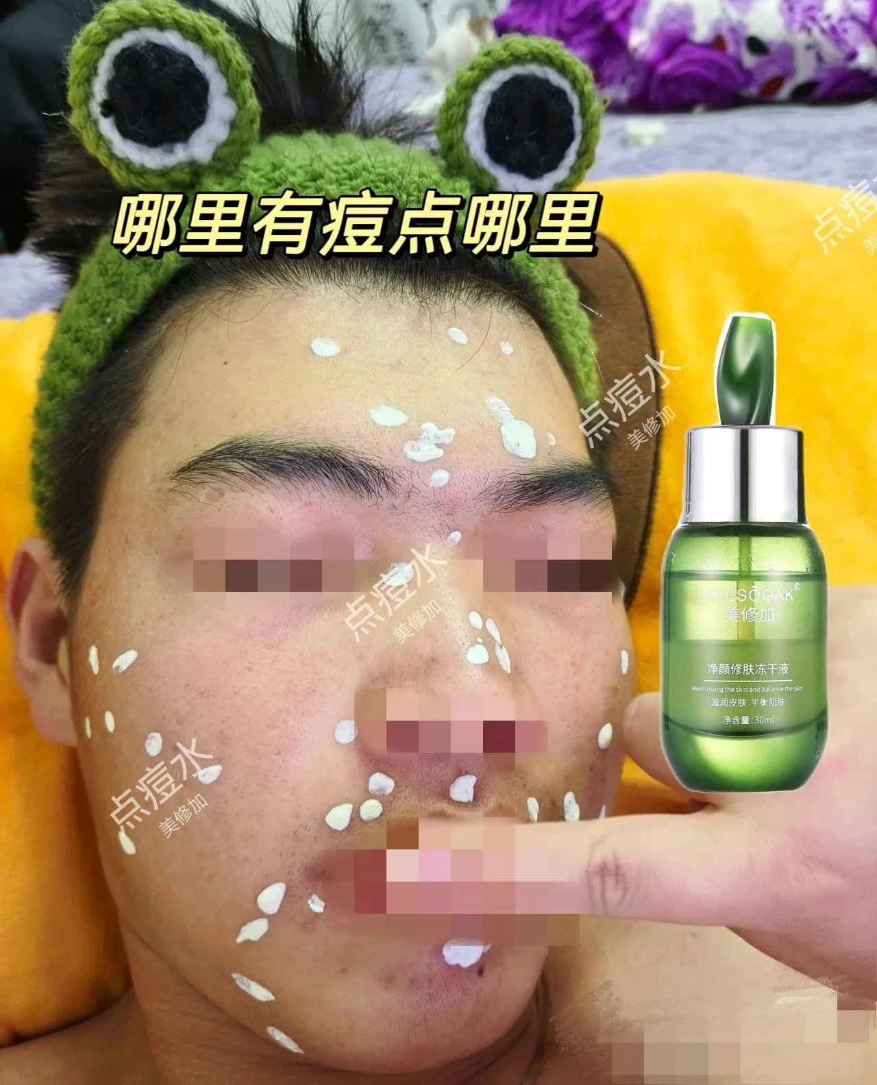 美修加净颜修肤冻干液，点痘水祛痘水 图片 6
